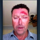 Illustration for article titled Witness: Robert Allenby Hurt Himself After A Trip To The Strip Club
